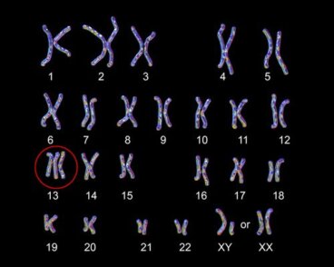 Altérations chromosomiques autosomiques