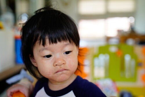 Pyrosis Enfant Pityriasis rosé chez les enfants: causes, symptômes et traitement