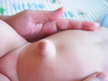 Hernie ombilicale chez le bébé : tout ce qu'il faut savoir