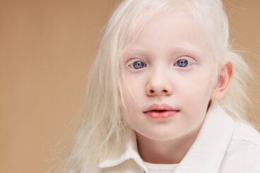 Comment prendre soin de la peau d'un enfant albinos?
